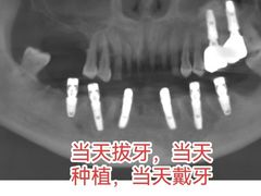 -维乐口腔(美维云门诊陆家嘴店)