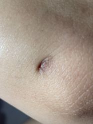 -西安现代妇产医院医疗美容