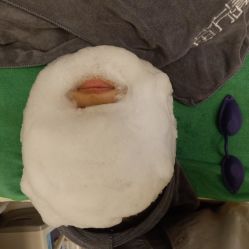 -苗方清颜·祛痘皮肤管理