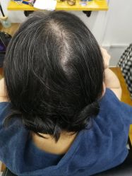 -髻尚坊增发补发织发假发定制