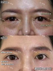 -杭州米兰柏羽医疗美容医院