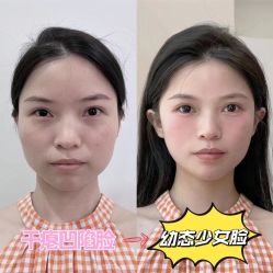 -Yestar重庆艺星医疗美容医院