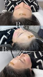 -RC半永久纹眉纹发际线