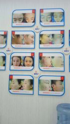 -悟空祛痘·诺奖技术专业店