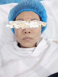 体验后-坤如玛丽·医疗美容中心