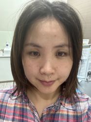 体验后-上海漾颜医疗美容