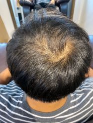 -髻尚坊增发补发织发假发定制