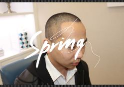 -大麦微针植发全国连锁