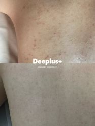 点击看大图 -Deeplus+韩国皮肤管理한국피부관리·C:Lab肌肤实验室