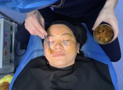 -天津健丽·去眼袋医疗美容机构