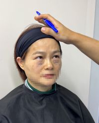 -天津健丽·去眼袋医疗美容机构