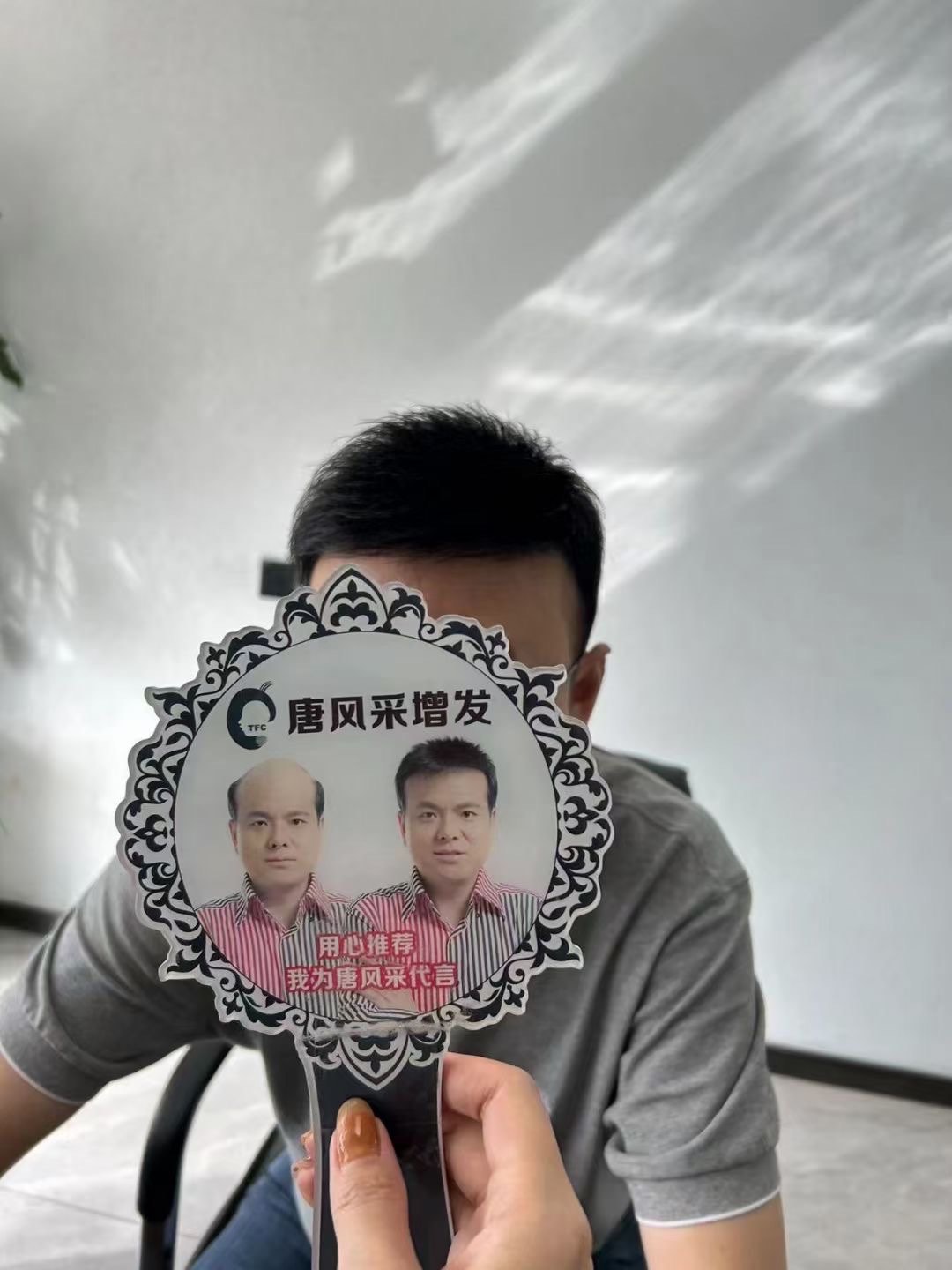 辞职植发(上班族植发手术需要请几天假?)