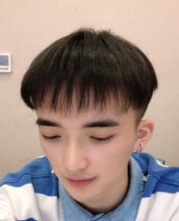 -大麦微针植发全国连锁