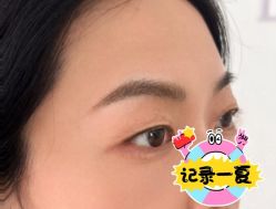 -德绣·机器野生眉发际线·美瞳线半永久