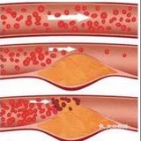 护血管、促循环，受益一辈子