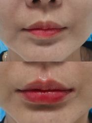 -上海玫瑰医疗美容医院