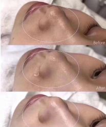 -美肤盾祛痘·问题肌头疗管理中心