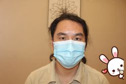 -大麦微针植发丨全国连锁