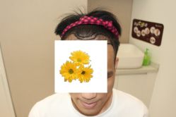 -大麦微针植发丨全国连锁