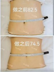 点击看大图 -Lily纤美·科技减脂中心