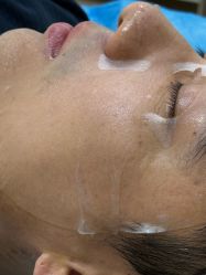 -长沙雅美医疗美容医院