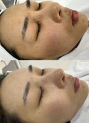 -美愈美肤MEIYU SKIN