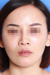 -圣嘉新医疗美容医院