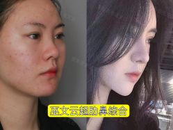 -北京米扬丽格医疗美容·联合丽格鼻整形中心