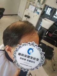 -唐风采假发补发定制
