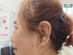 -安湃声助听器(同仁医院店)