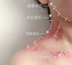 -D5季美容SPA