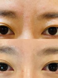 点击看大图 体验前-天津伊美尔医疗整形美容专科医院