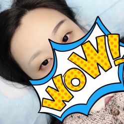 点击看大图 -郡艺医疗美容·微整·眼鼻吸脂
