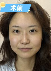 -素美医疗美容·西南眼鼻整形·修复基地