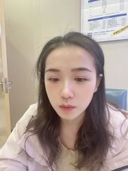-大麦微针植发全国连锁