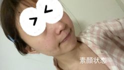 -北京米扬丽格医疗美容·联合丽格鼻整形中心