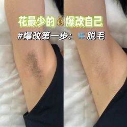 -薇兰专业脱毛连锁机构