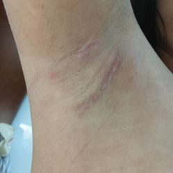 -广州美莱医疗美容医院