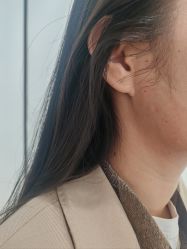 体验后-四川米兰柏羽医学美容医院