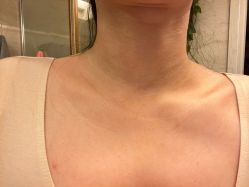 -深圳春天阳光医院·轮廓抗衰中心