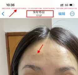 体验后-深圳阳光医疗美容医院·旗舰店