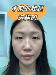 -素美医疗美容·西南眼鼻整形·修复基地
