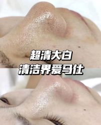 -SKIN79皮肤管理中心