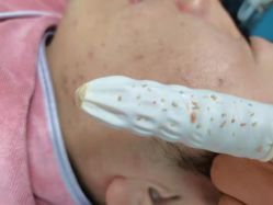 -荟草堂专业祛痘修护中心