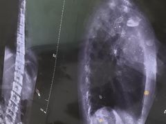 -张钰强中医正骨推拿连锁(华发商都店)