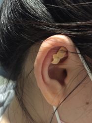 -肥三针腧穴瘦身馆