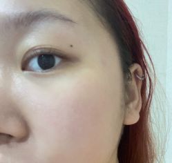 体验后-伊丽莎白医疗美容
