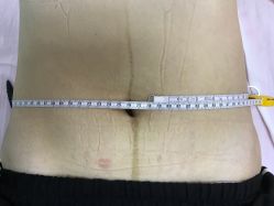 -亮丽妈妈·催乳通乳·产后恢复(万达店)