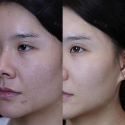 -Yestar重庆艺星医疗美容医院