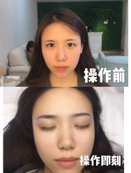-久匠·纹眉纹绣半永久